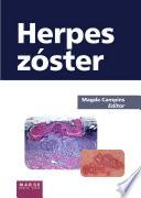 Libro Herpes zóster