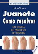 Libro Juanete - Resolver sin cirugía